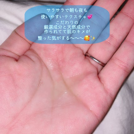 エンリッチ ローション/サイクルプラス/化粧水を使ったクチコミ(3枚目)