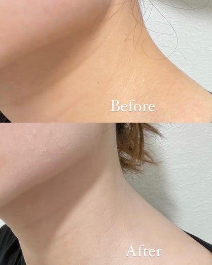 Non/フォロバ100 on LIPS 「ァンデーション塗った時、首との色の差異出てしまっていない?TI..」(5枚目)