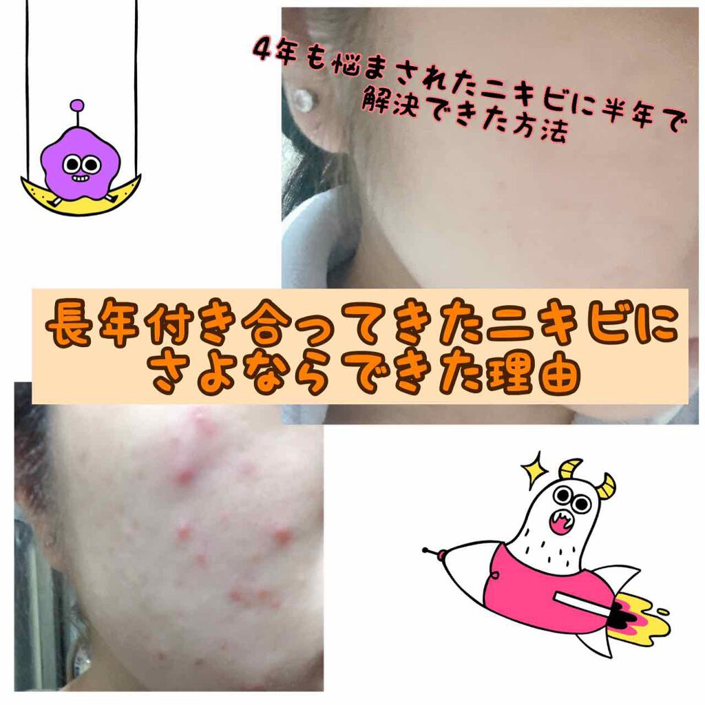 DHC はとむぎエキス/DHC/健康サプリメントを使ったクチコミ（1枚目）