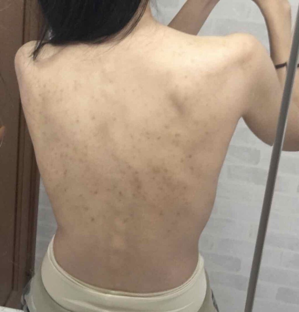 ロゼットゴマージュ/ロゼット/ピーリングを使ったクチコミ(3枚目)