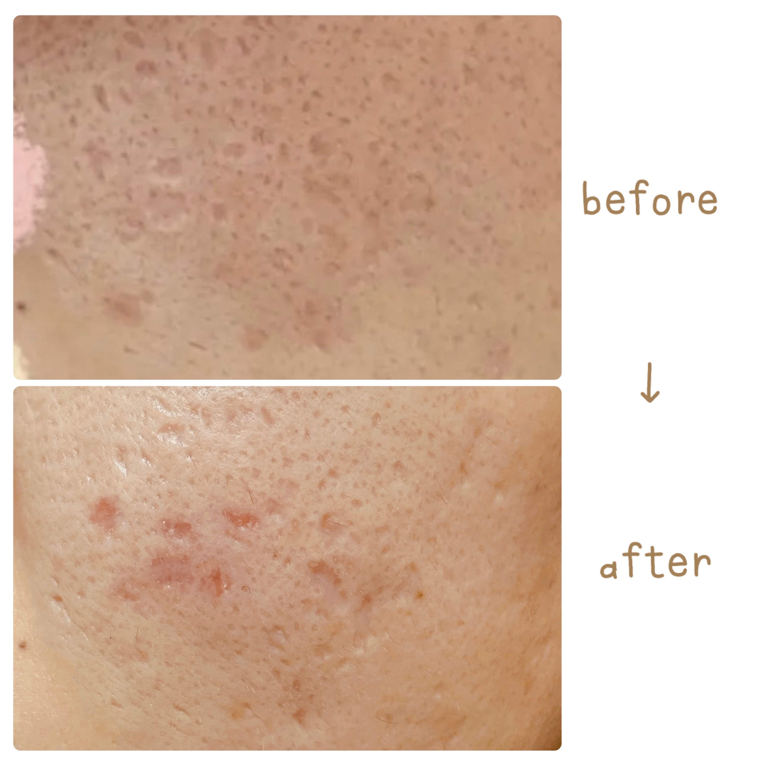 を使ったクチコミ（2枚目）