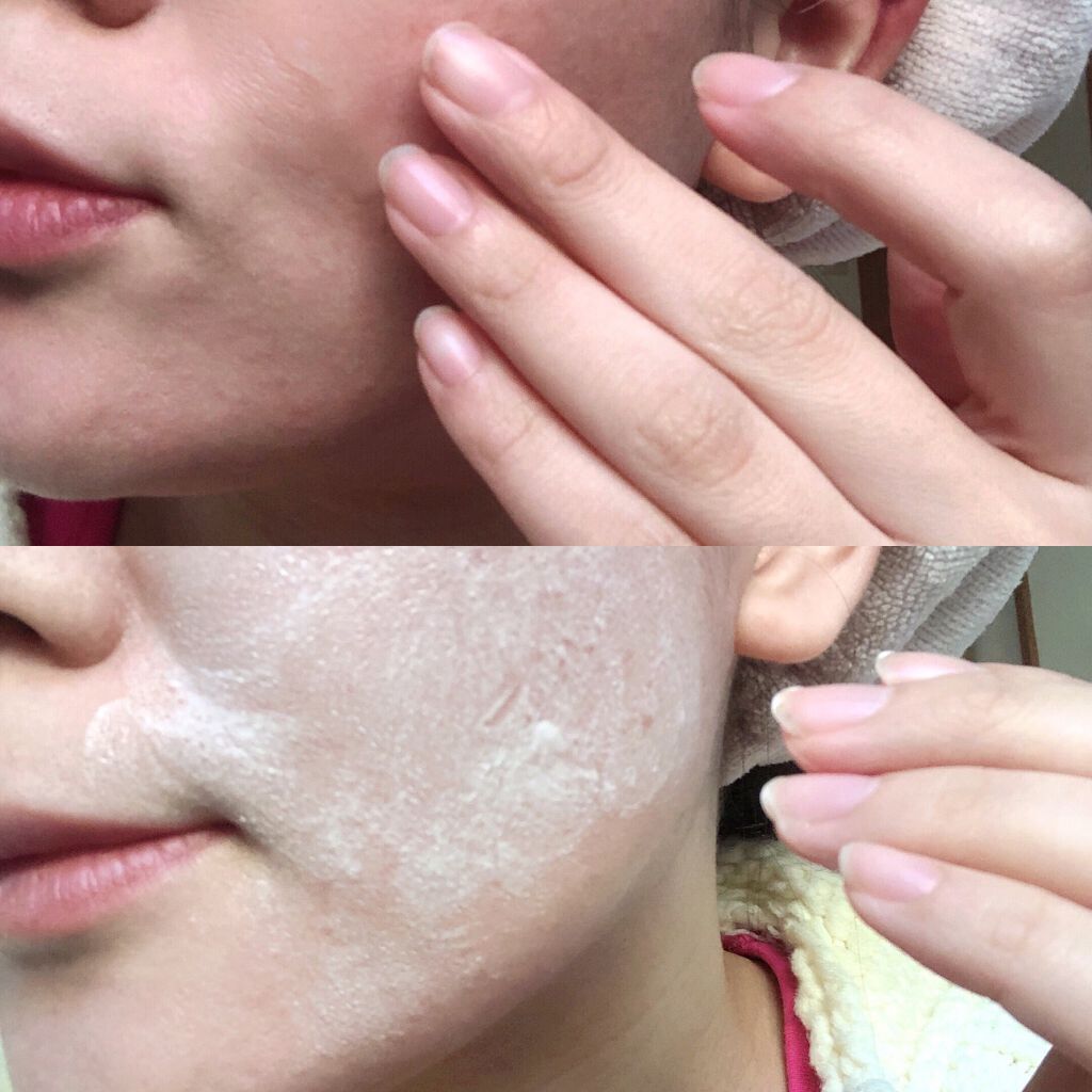 パーフェクトC クレンジング&洗顔ジェル/Perfect C/クレンジングジェルを使ったクチコミ(3枚目)