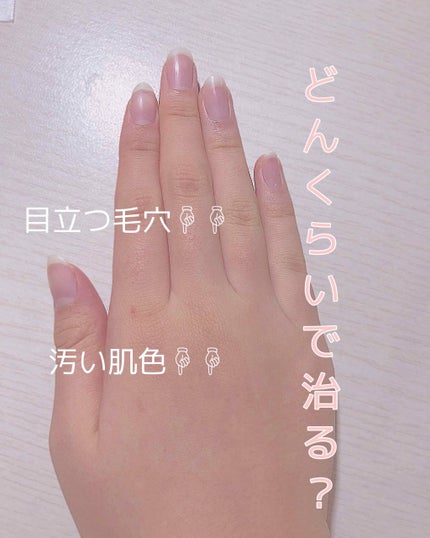 ニベアクリーム/ニベア/ボディクリームを使ったクチコミ(1枚目)