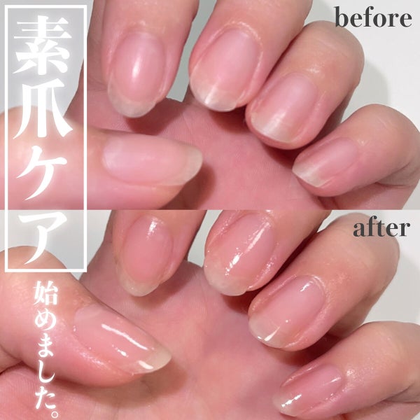 エテュセ クイックケアコート/ettusais/ネイルオイル・トリートメント by m.cherry🍒