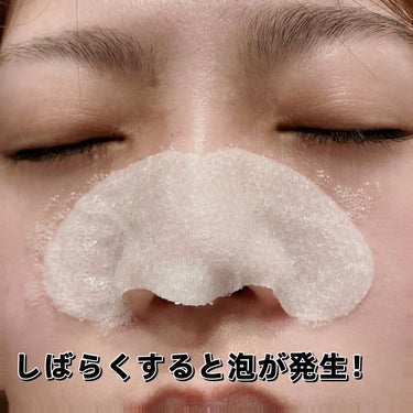 鼻 バブルパック/CNP Laboratory/シートマスク・パックを使ったクチコミ（3枚目）