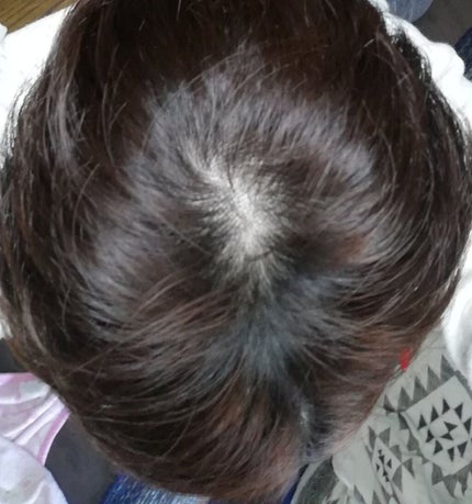 カラージェニック ミルキーヘアカラー (ちらっと白髪用)/サイオス/ヘアカラーを使ったクチコミ(4枚目)