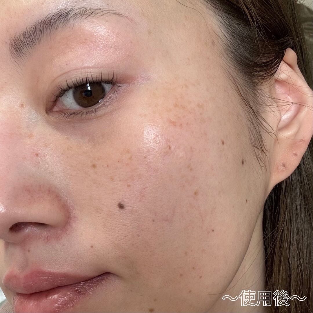 ルクエ コンク/ナリス化粧品/拭き取り化粧水を使ったクチコミ（3枚目）