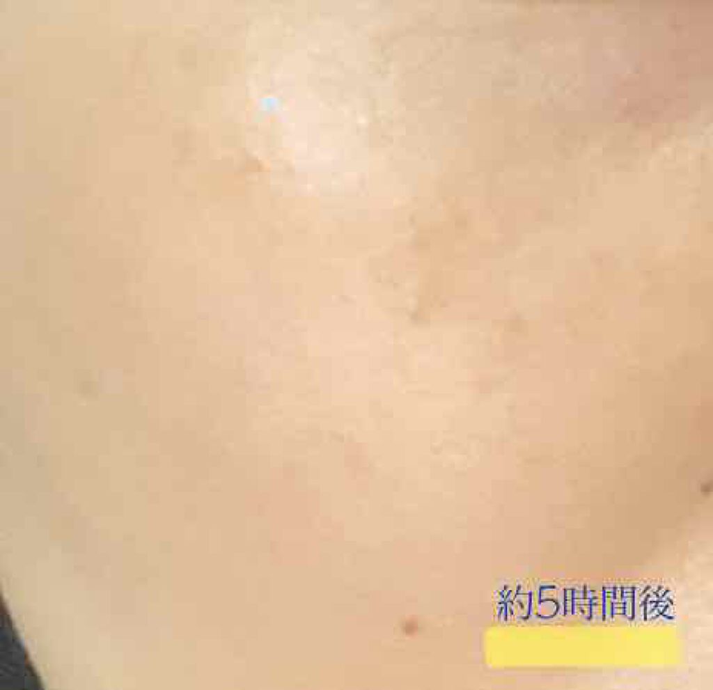 3Dコントラスティングチークス/KATE/パウダーチークを使ったクチコミ(4枚目)