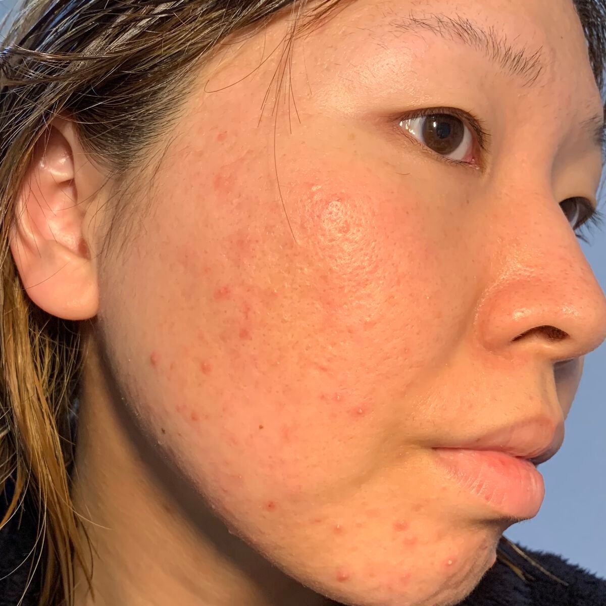 ル リフト ローション/CHANEL/化粧水を使ったクチコミ(8枚目)