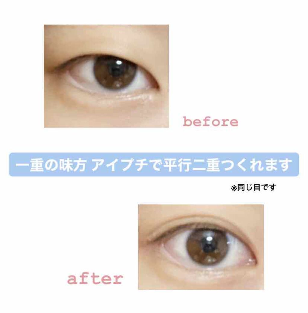 アイビューティー フィクサー WP/アストレア ヴィルゴ/二重まぶた用アイテムを使ったクチコミ(1枚目)