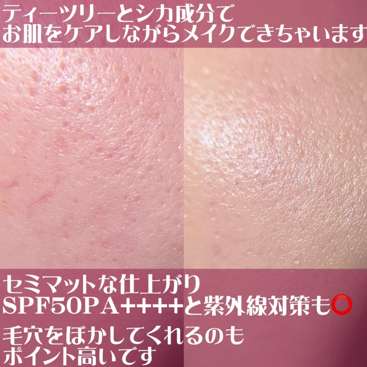 ピンクティーツリーカバークッション/APLIN/クッションファンデーションを使ったクチコミ(3枚目)