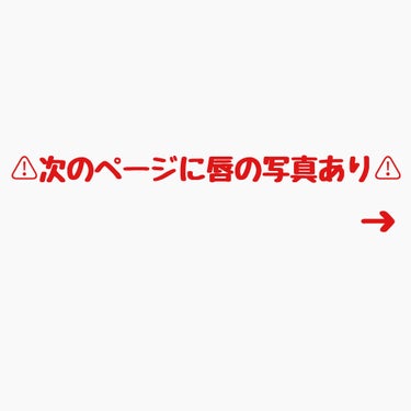 リップフォンデュ/メンソレータム/リップケア・リップクリームを使ったクチコミ（3枚目）