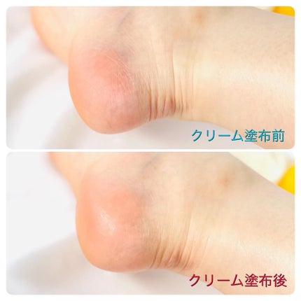 ゴウンバル クリーム/3WB/レッグ・フットケアを使ったクチコミ(4枚目)