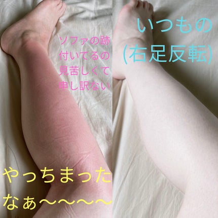 北海道シカローション/idio/化粧水を使ったクチコミ(2枚目)