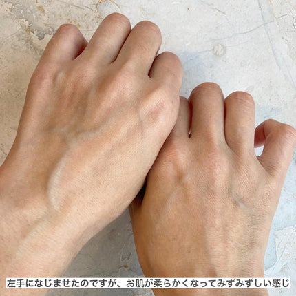 エリー on LIPS 「𓅰𓅰𓅰𓂃𓈒𓂂𓏸𓐍◌⋆꙳ニキビなどの肌荒れからエイジングまで..」(6枚目)