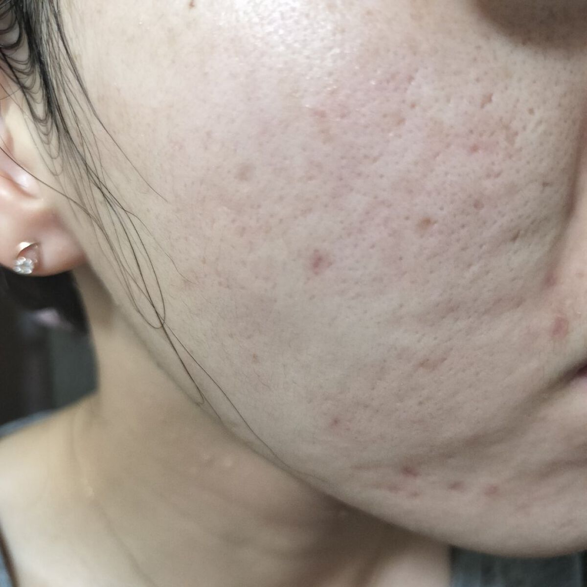 100LAAインパウダー/The Ordinary/その他スキンケアを使ったクチコミ（1枚目）