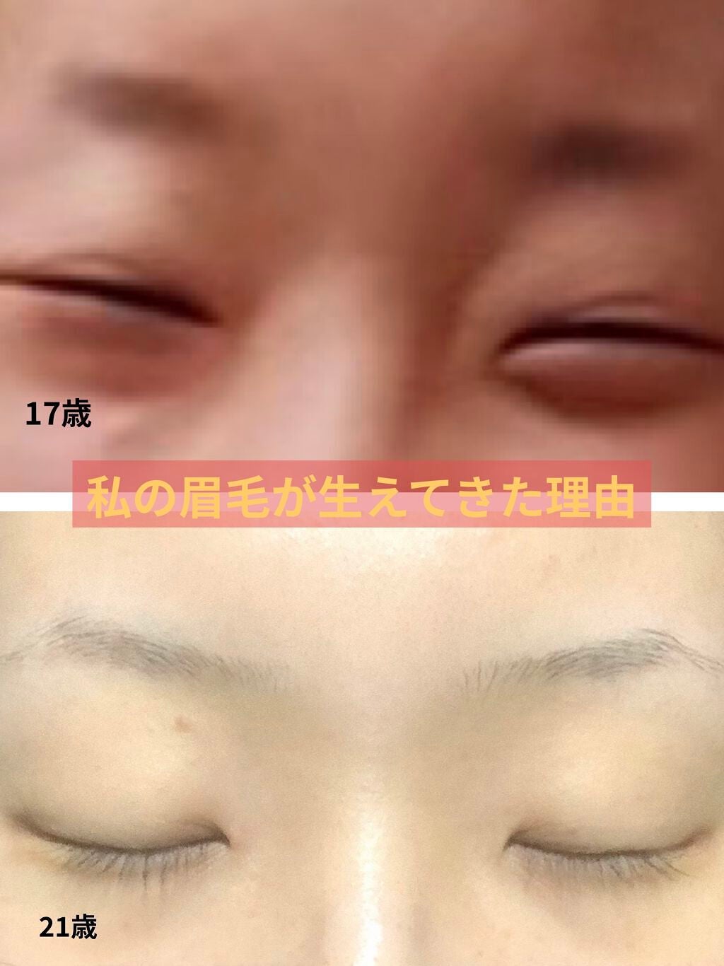 オリジナル ピュアスキンジェリー/ヴァセリン/ボディクリームを使ったクチコミ(1枚目)