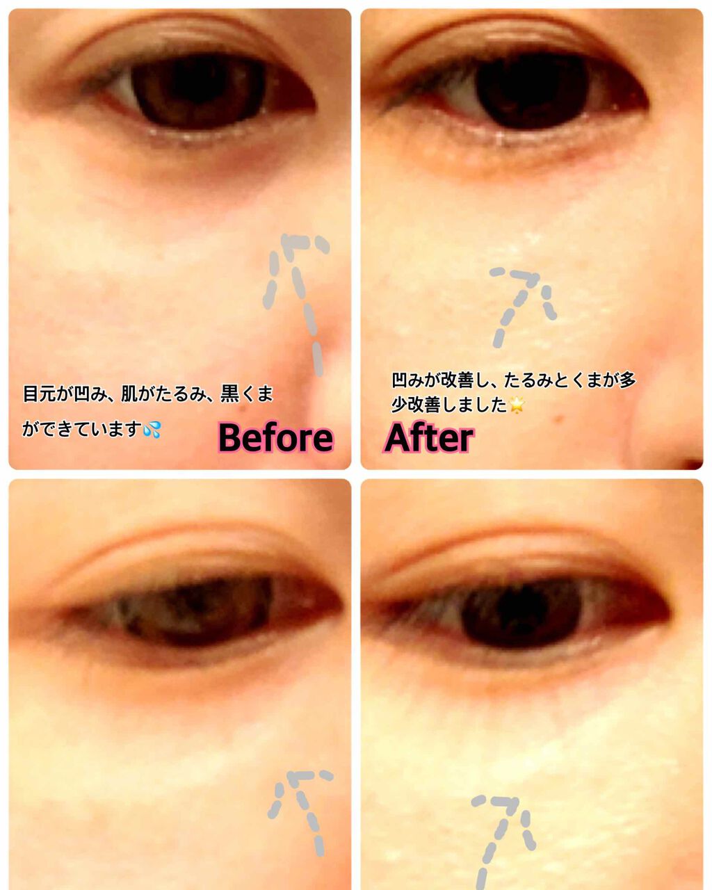 リンクル リペアリフト/ALBION/アイケア・アイクリームを使ったクチコミ(2枚目)