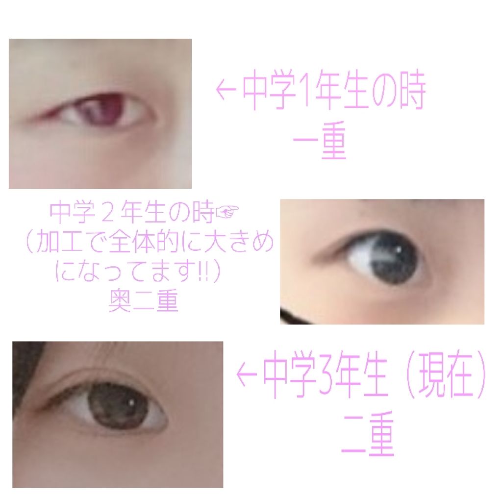 アイトーク アイトークを使った口コミ 元一重が教える二重までの道 こんばんは By Lapis 普通肌 10代前半 Lips
