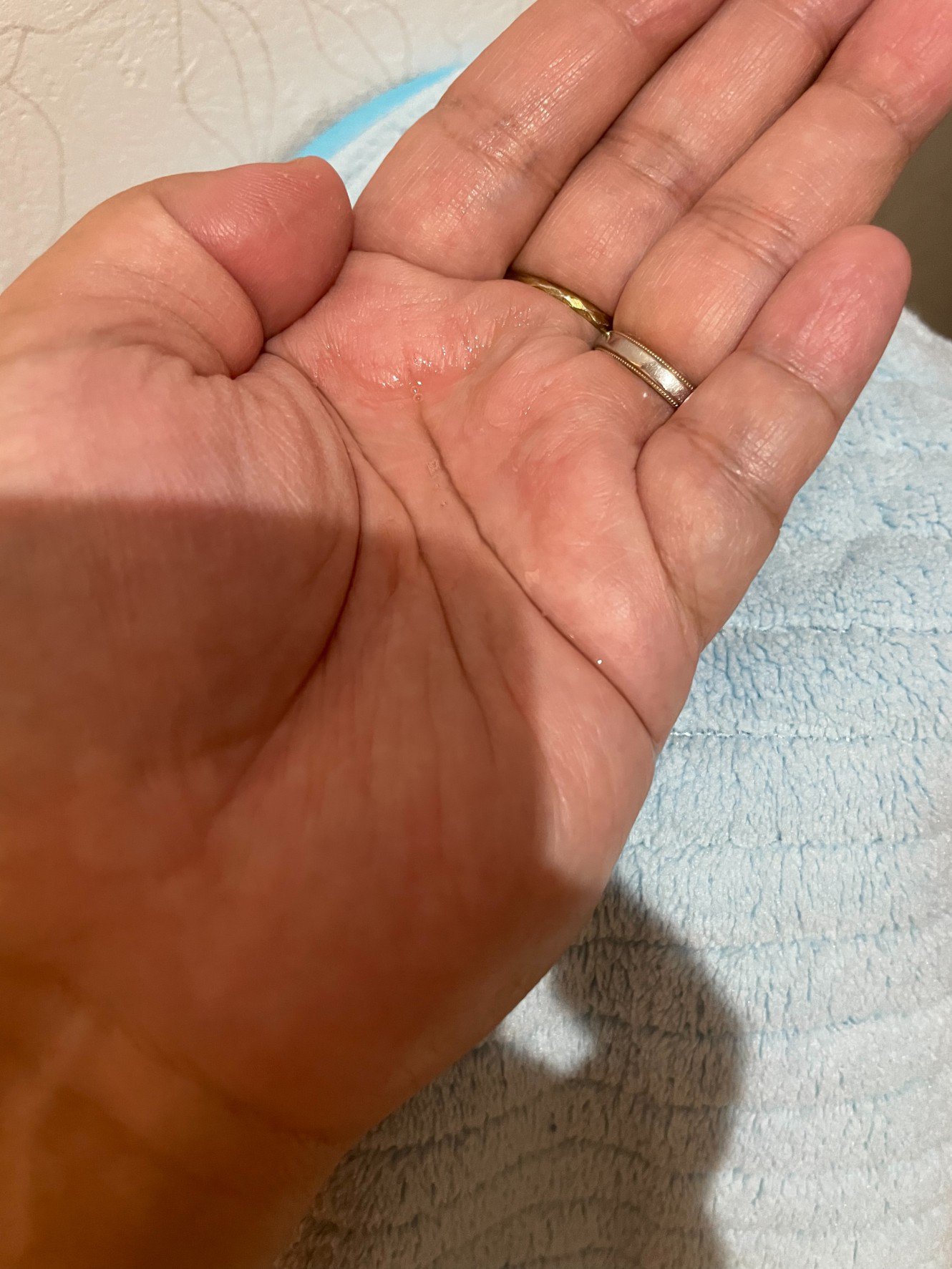 センテラ ライトクレンジングオイル/SKIN1004/オイルクレンジングを使ったクチコミ（2枚目）