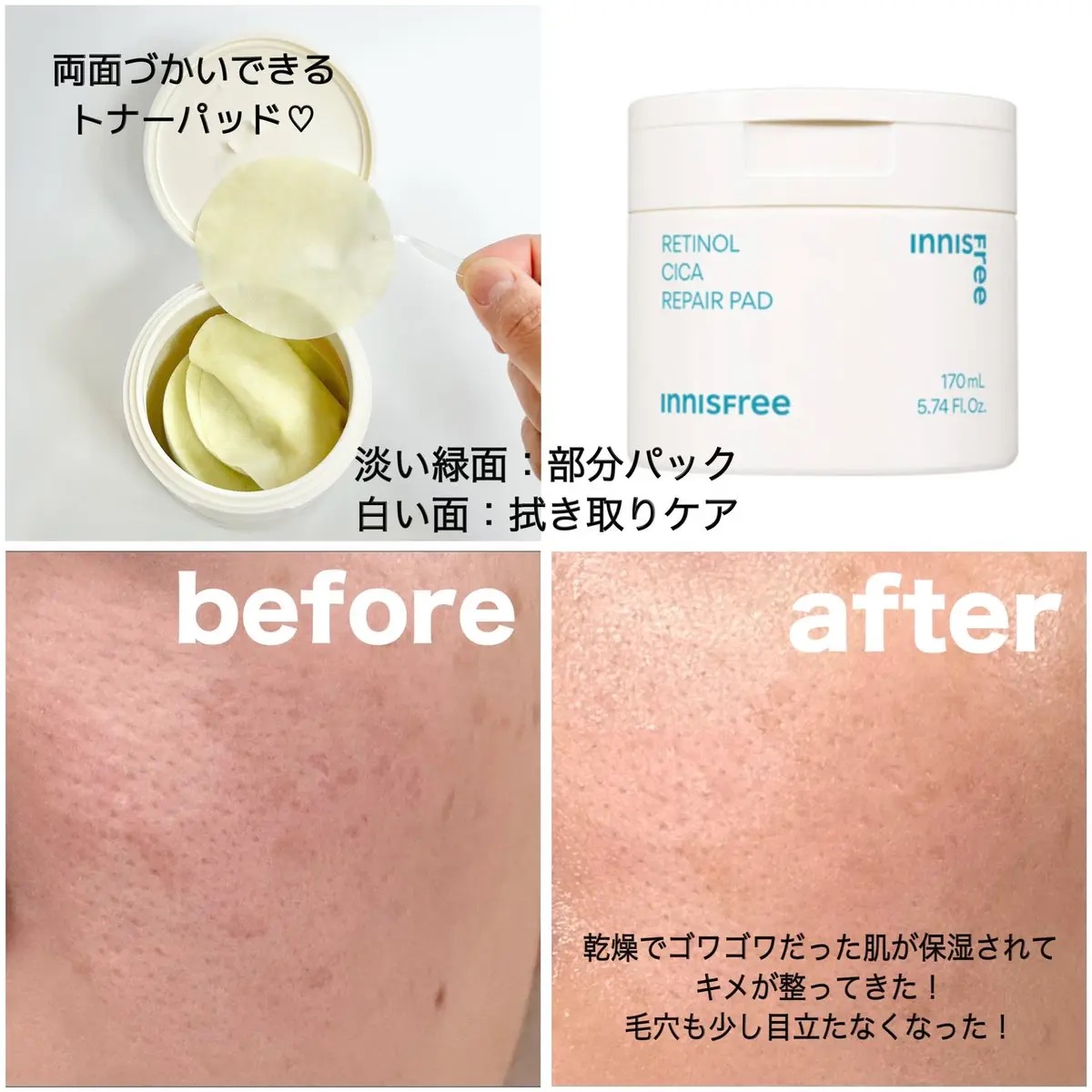 レチノール シカ リペア パッド/innisfree/トナーパッドを使ったクチコミ（2枚目）