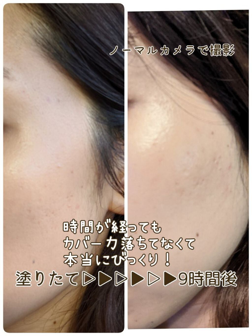 ピンクティーツリーカバークッション/APLIN/クッションファンデーションを使ったクチコミ(5枚目)