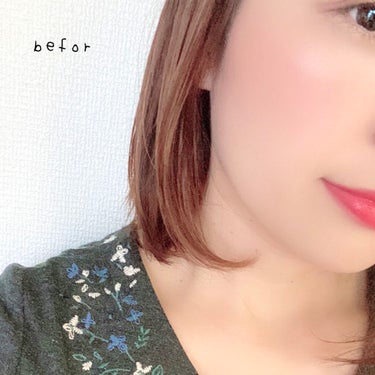 きみばな on LIPS 「ヘアアクセルルーターのビフォーアフター！髪が早く伸びるというア..」（2枚目）