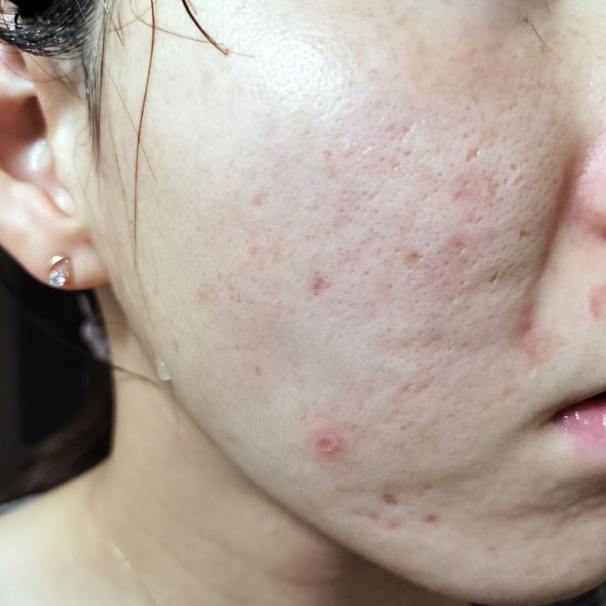 ワセリンHG チューブ (化粧用油)/大洋製薬/ボディクリームを使ったクチコミ（1枚目）