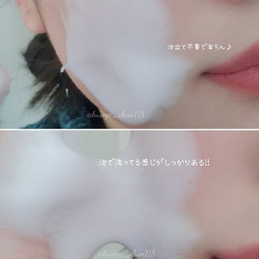 モッチスキン吸着泡洗顔FS(イチゴ)/MoccHi SKIN/泡洗顔を使ったクチコミ（3枚目）