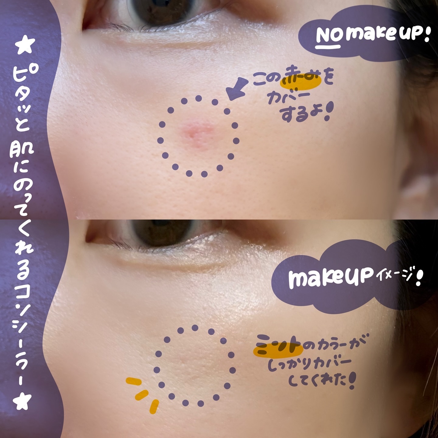 ブリージングコンシーラーパレット/Healus/パレットコンシーラーを使ったクチコミ（3枚目）