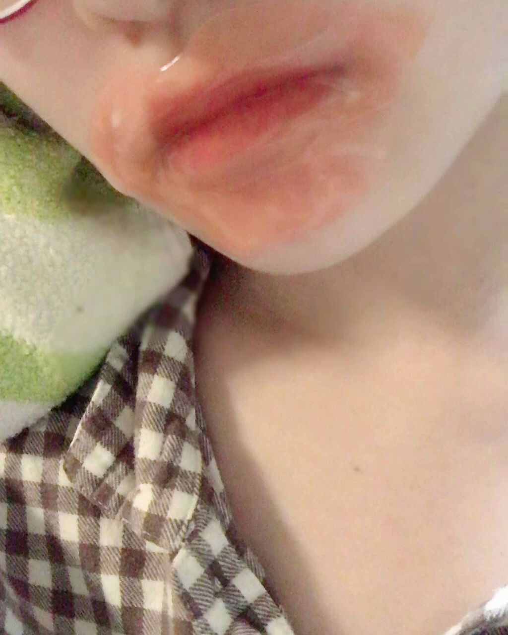 リップパック	/CHOOSY/リップマスクを使ったクチコミ（2枚目）