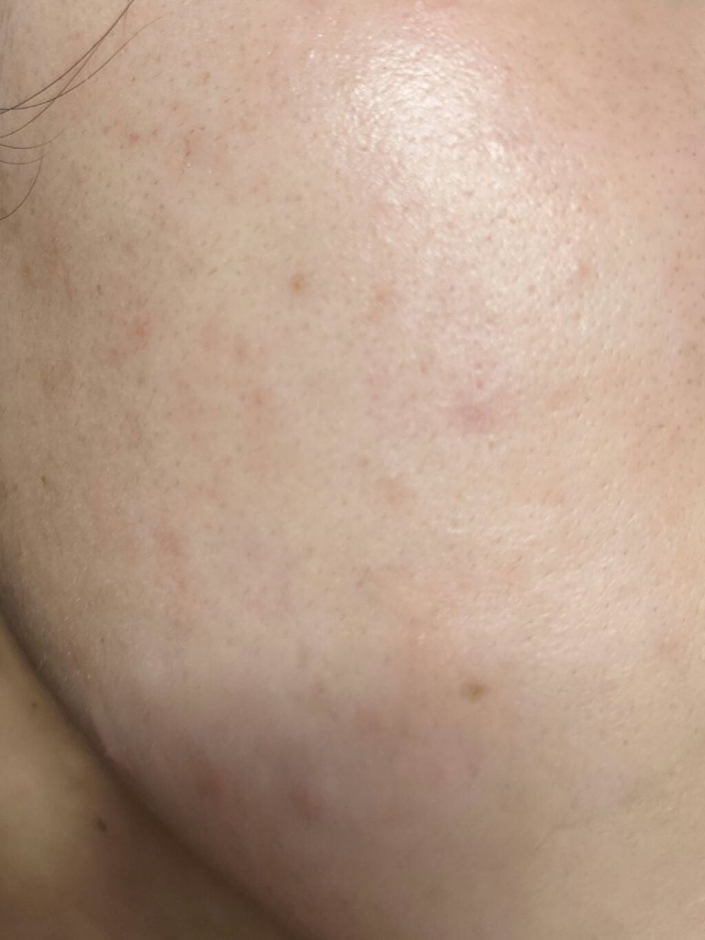 DHC はとむぎエキス/DHC/健康サプリメントを使ったクチコミ(8枚目)