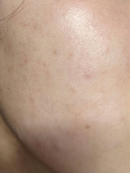 DHC はとむぎエキス/DHC/健康サプリメントを使ったクチコミ(8枚目)