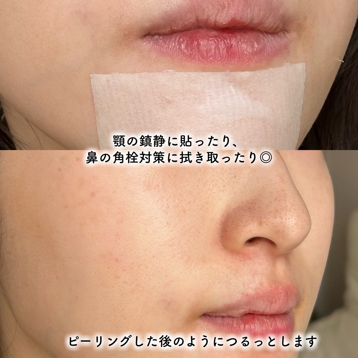 シカピーリングトナーパッド/ONE THING/トナーパッドを使ったクチコミ(6枚目)