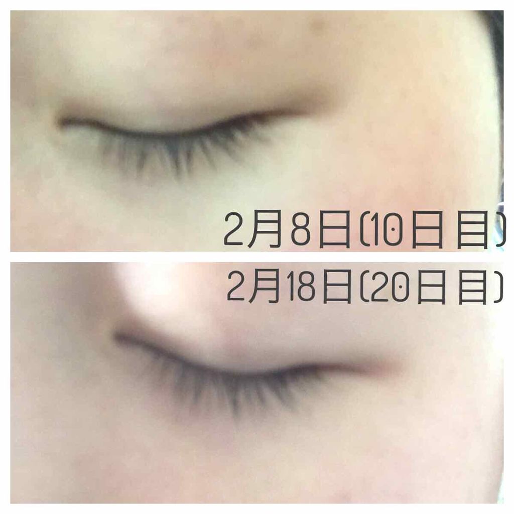 リバイタラッシュ アドバンス ジャパン/エム・アール・アイ/まつげ美容液を使ったクチコミ(2枚目)