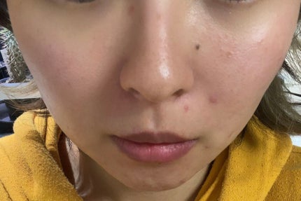 ライトリフレクティングセッティングパウダー プレスト N/NARS/プレストパウダーを使ったクチコミ(3枚目)