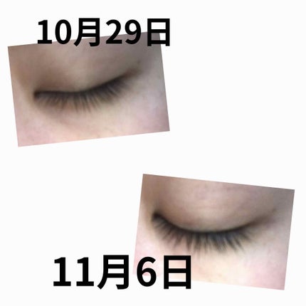 ラッシュ セラム/ロレアル パリ/まつげ美容液を使ったクチコミ(3枚目)