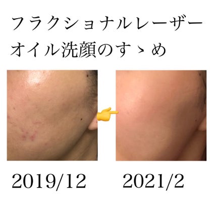Jojoba Oil/Now Foods/フェイスオイルを使ったクチコミ(1枚目)