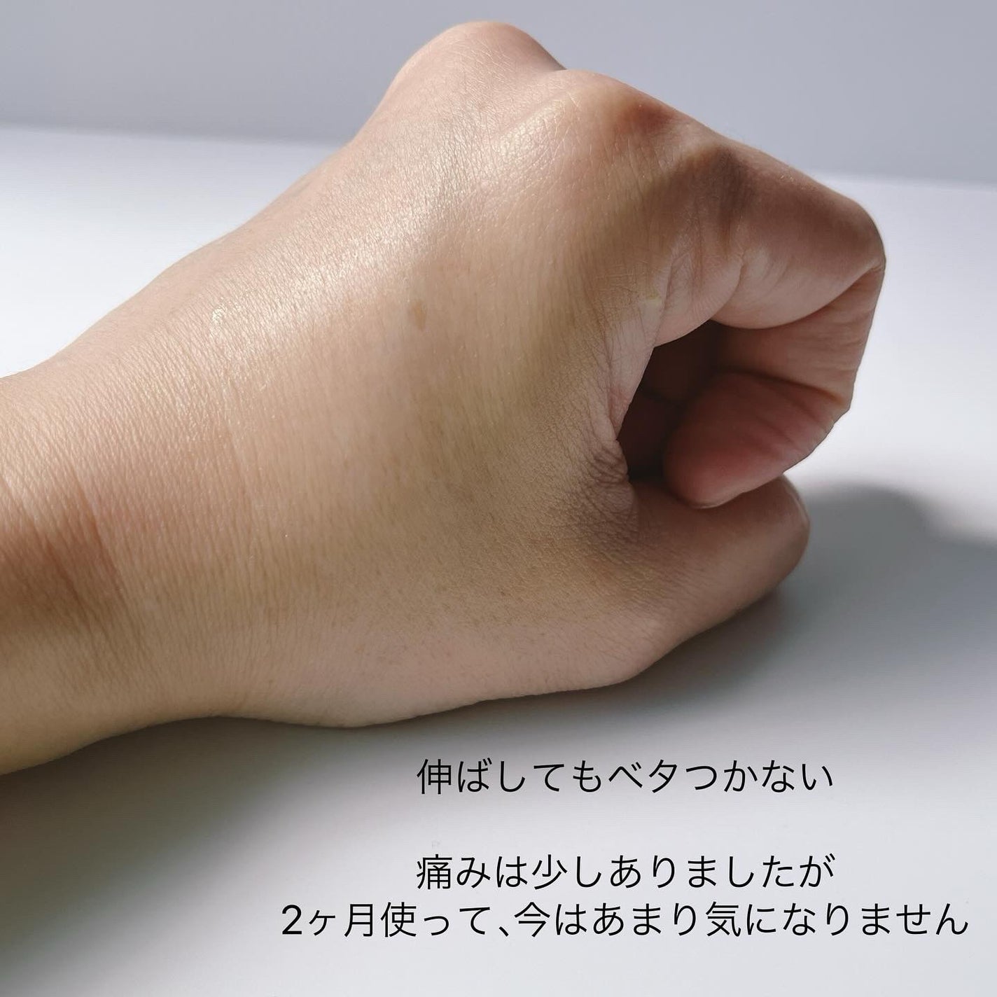 シカレチA エッセンス0.5/VT/美容液を使ったクチコミ(3枚目)