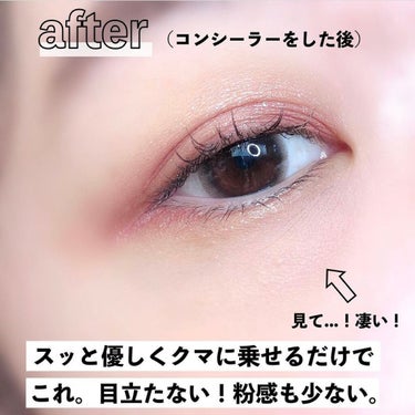 EXPERT CONCEALER （エクスパートコンシーラー）/VDL/リキッドコンシーラーを使ったクチコミ（7枚目）