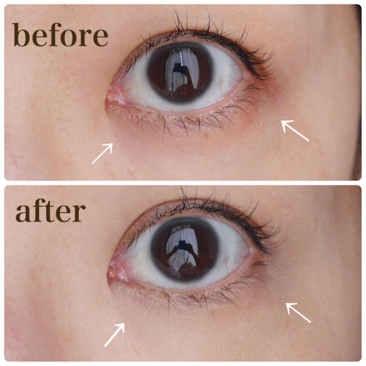 デザイニング コンシーラー/ブリリアージュ/リキッドコンシーラーを使ったクチコミ(4枚目)