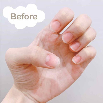 ネイルベッドオイル/アンドネイル/ネイルオイル・トリートメントを使ったクチコミ(2枚目)