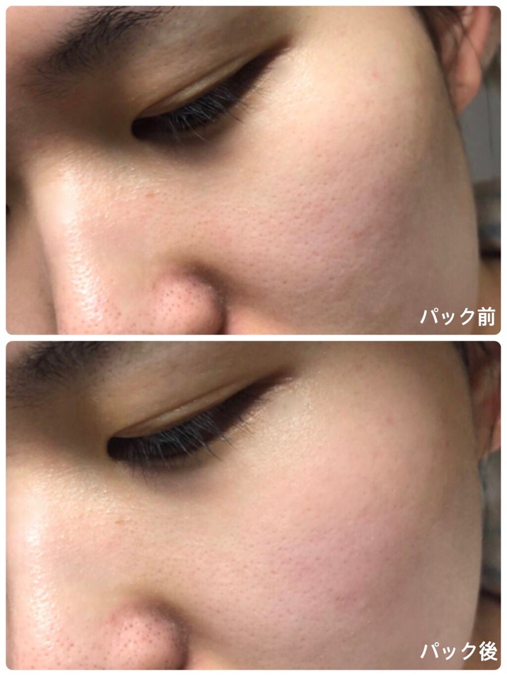 お米のマスク/毛穴撫子/シートマスク・パックを使ったクチコミ(4枚目)