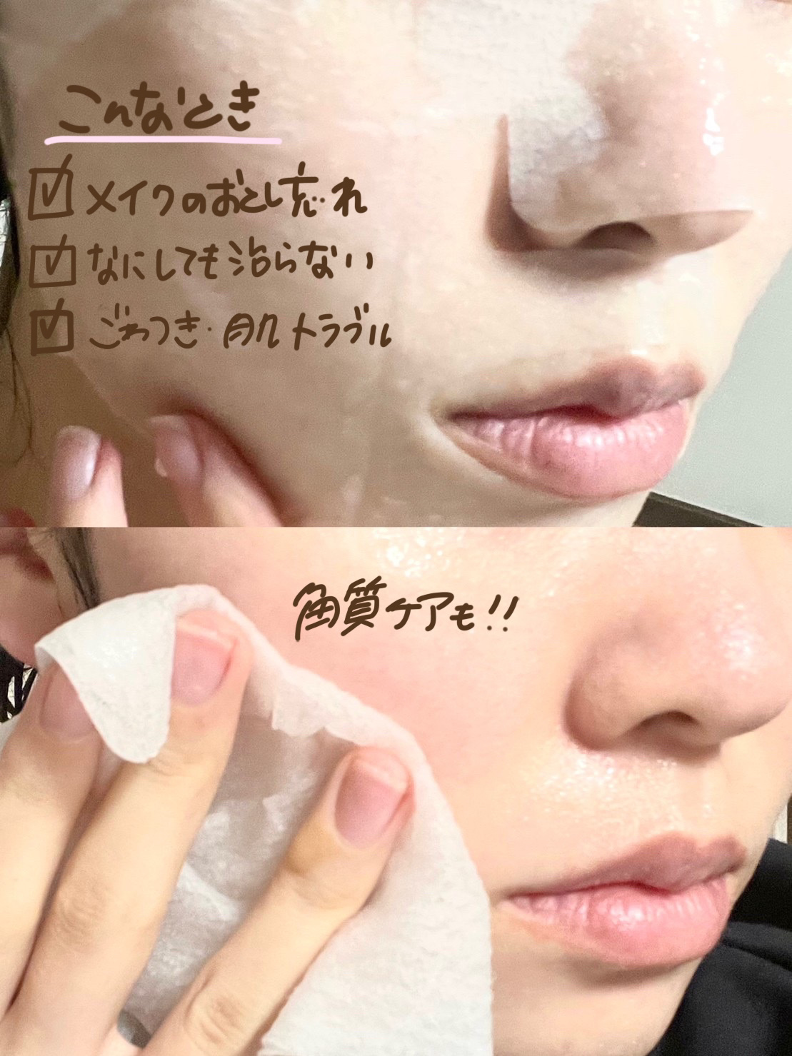 ごめんね素肌マスク/クリアターン/シートマスク・パックを使ったクチコミ（2枚目）