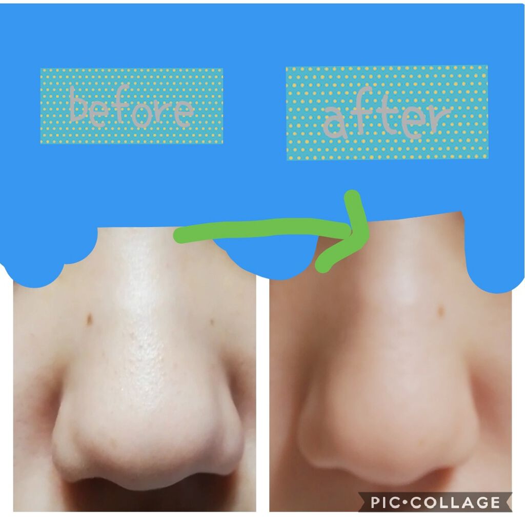 毛穴すっきりパック 鼻用 白色タイプ/ビオレ/その他スキンケアを使ったクチコミ(2枚目)