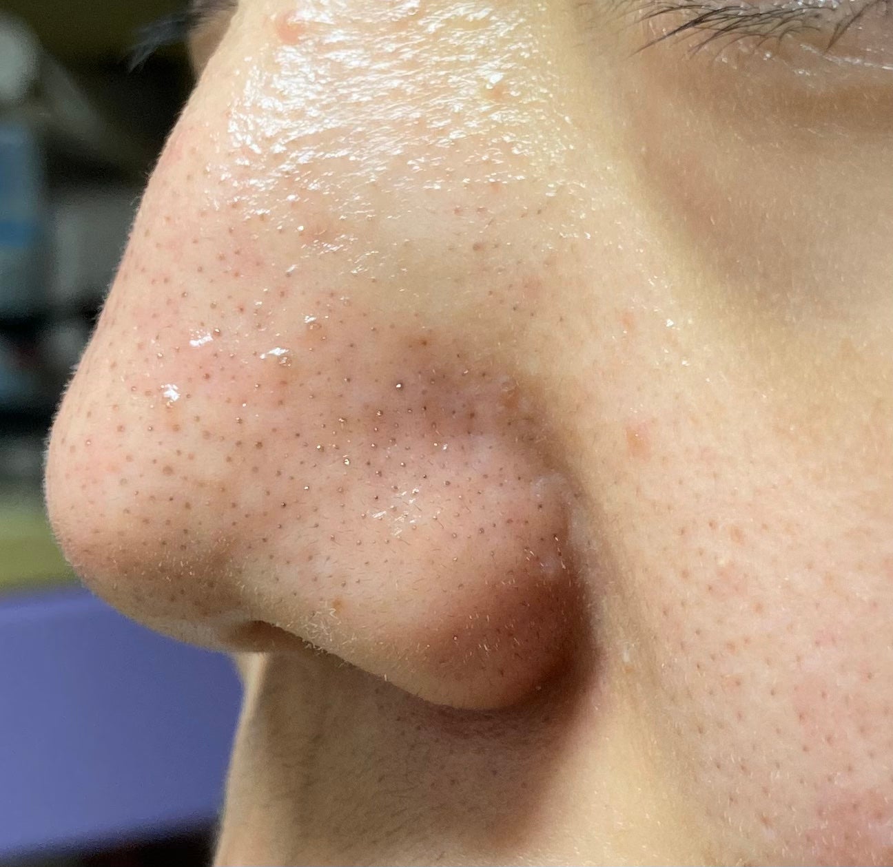 ããããð on LIPS ãæ¯ç©Žã®é»ãã¿ã«3幎ãããæ©ãã§ãŸãð髿 ¡3幎ã§ããæ··åèã§ç®è..ãïŒ4æç®ïŒ