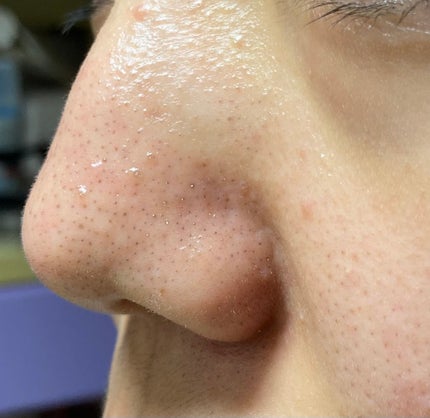 ããããð on LIPS ãæ¯ç©Žã®é»ãã¿ã«3幎ãããæ©ãã§ãŸãð髿 ¡3幎ã§ããæ··åèã§ç®è..ãïŒ4æç®ïŒ