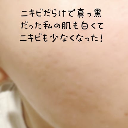 C+クリアセラム/ヴィオテラス/美容液を使ったクチコミ(3枚目)