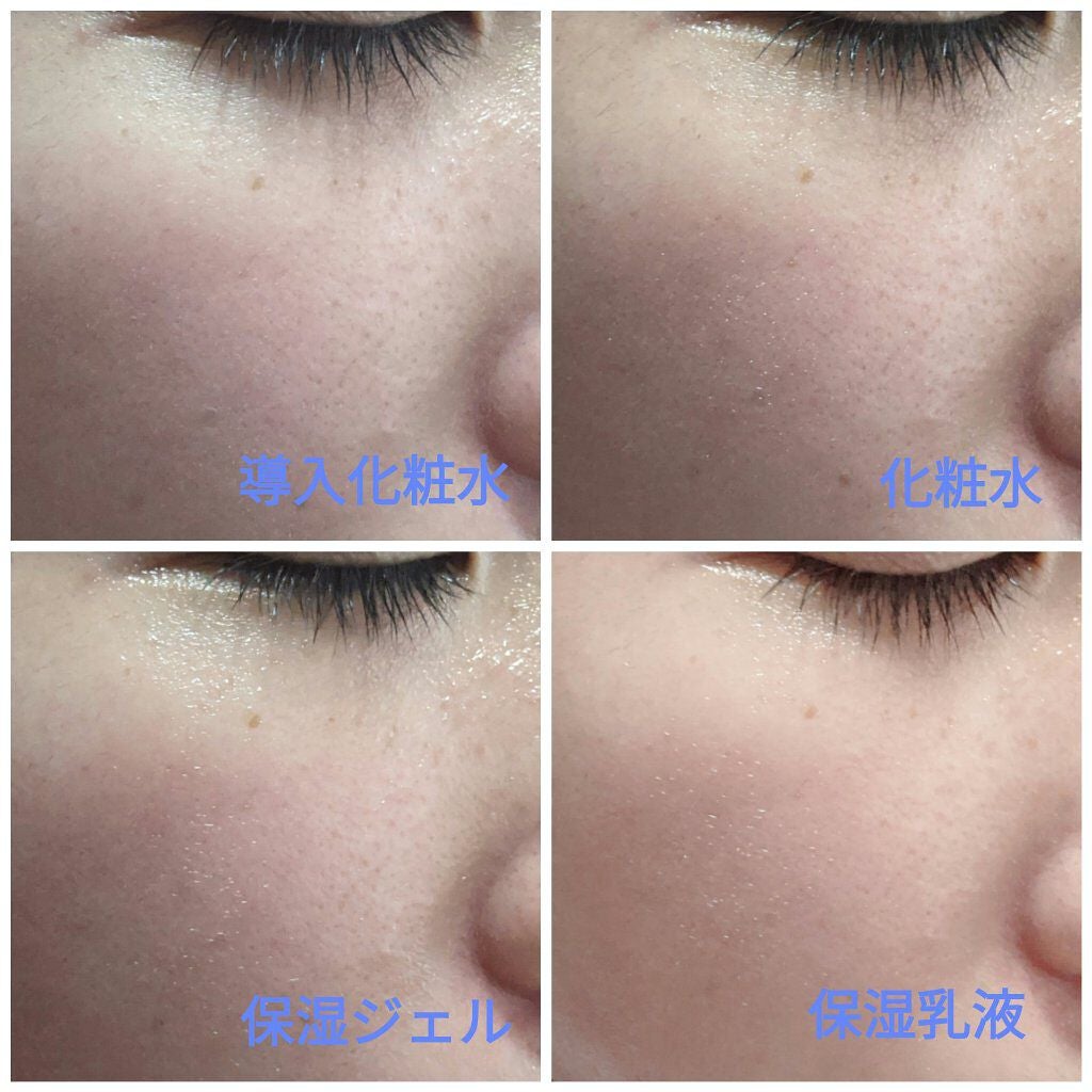 ハトムギ保湿ジェル(ナチュリエ スキンコンディショニングジェル)/ナチュリエ/美容液を使ったクチコミ(6枚目)