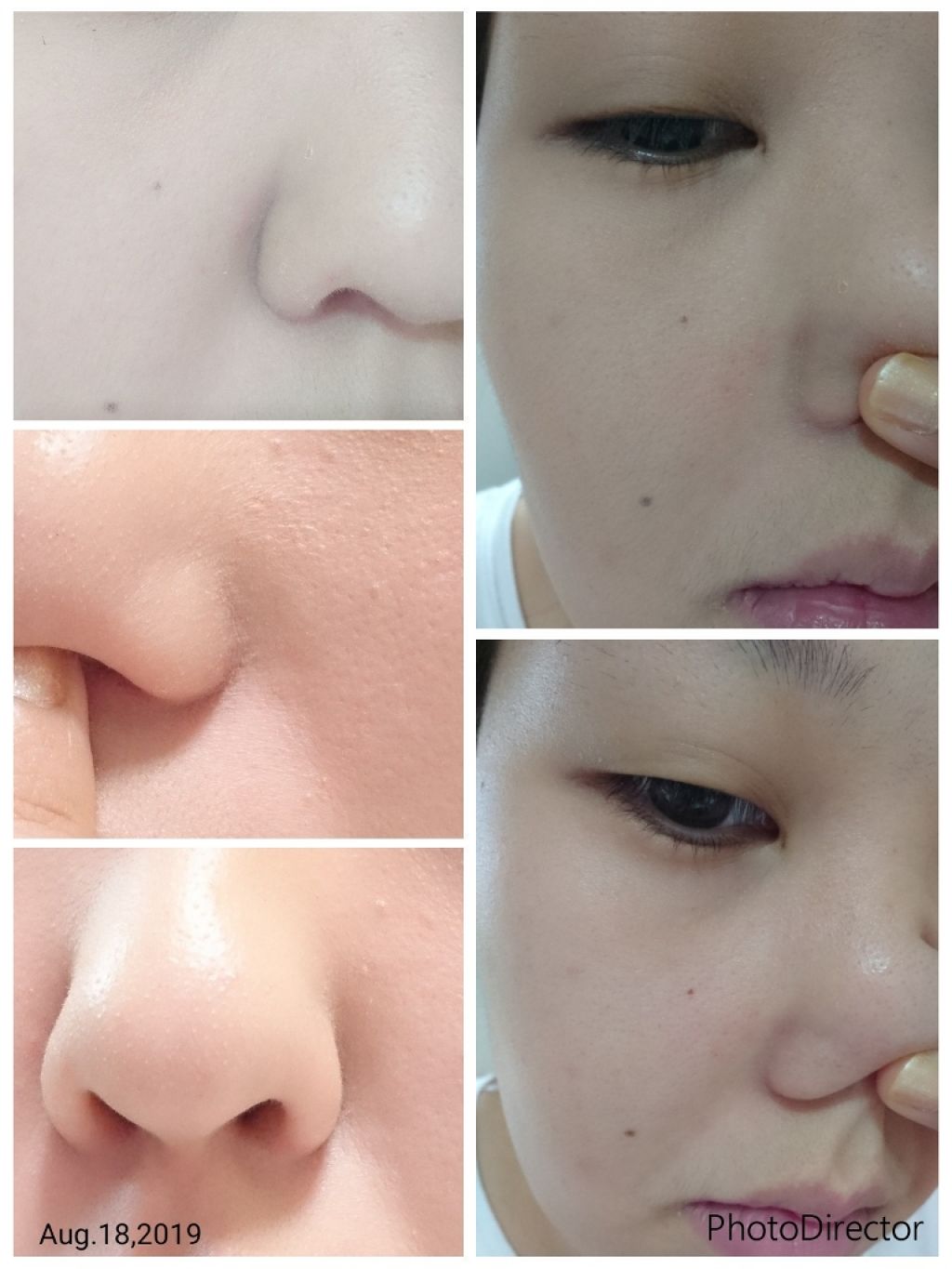 ドラマティックパウダリー UV/マキアージュ/パウダーファンデーションを使ったクチコミ(3枚目)